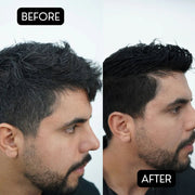 Rolda Black Hair Pomade 150g | Gray Hair Coverage - Magnus SupplyRolda
