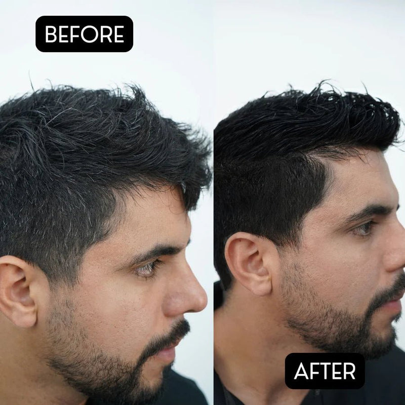 Rolda Black Hair Pomade 150g | Gray Hair Coverage - Magnus SupplyRolda